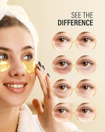 25-Pairs 24K Gold Eye Patches for Puffy Eyes, Dark Circles and Wrinkles
