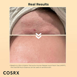 COSRX Snail Mucin 96% Power Repairing Essence: Hydrate, Repair, and Soothe Dull and Damaged Skin